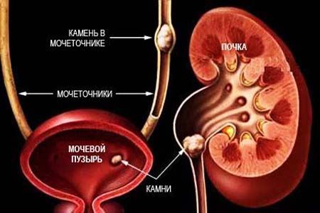 Мочевой пузырь у мужчин: расположение, объем и болезни (симптомы и лечение)