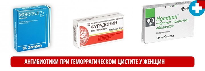 Цистит у женщин симптомы и лечение препаратами и дома Цистит у женщин симптомы и лечение препаратами и дома
